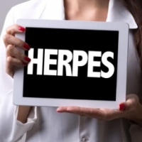 Herpes